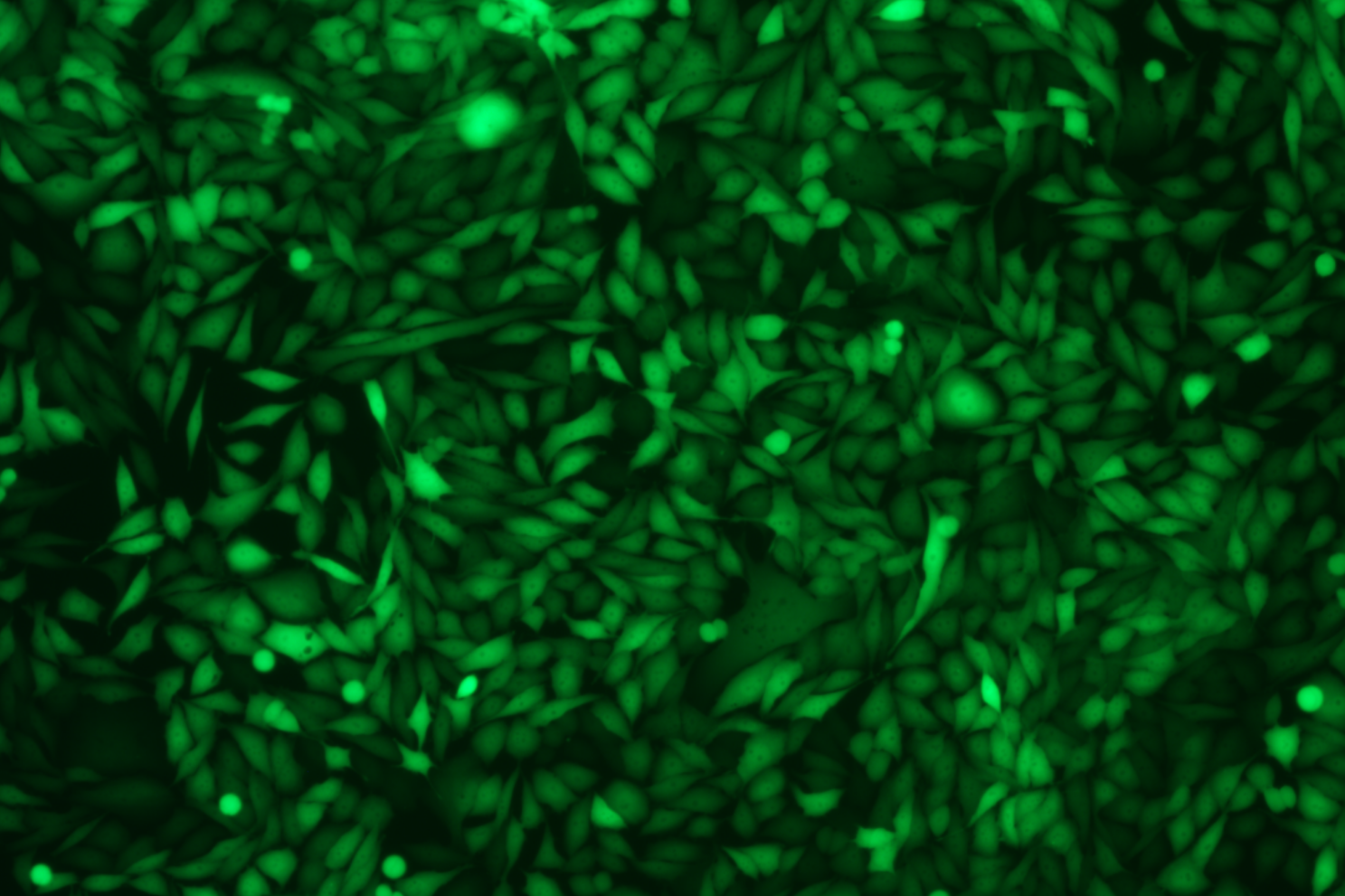 人前列腺癌细胞带增强型绿色荧光蛋白细胞PC-3+EGFP(STR鉴定正确)